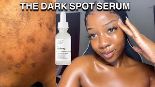 HOW TO GET RID OF DARK SPOTS WITH ONE PRODUCT  The ordinary [upl. by Namron]