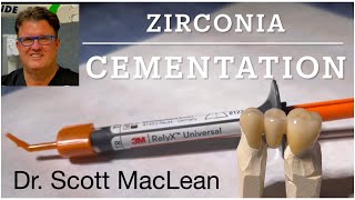 Zirconia Cementation with RelyX Universal Cement  Dr Scott MacLean  Dentist [upl. by Ahsien]