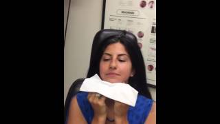 Nasal Splint removal  Post Surgery Septoplasty Rhinoplasty Full Video [upl. by Eiram]