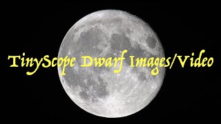 TinyScope Dwarf Images and Video [upl. by Anauqahc]