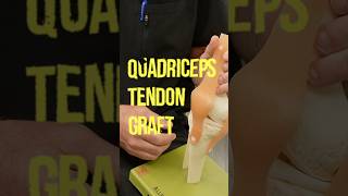 Here are some of the pros and cons of the quadriceps tendon graft🔥sports acl recovery [upl. by Towers]