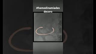 Angiografia renal hemodinamiadesdecero viralvideo angiografiarenal [upl. by Funda]