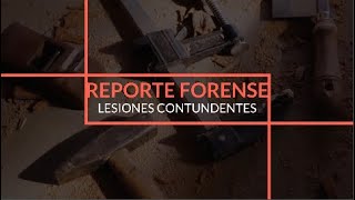 Reporte Forense  Lesiones contundentes Medicina Legal LUZ 2022 [upl. by Adnilg]