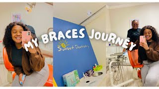 VLOG Braces installation five months review South African YouTuber 🇿🇦 [upl. by Akimehs]