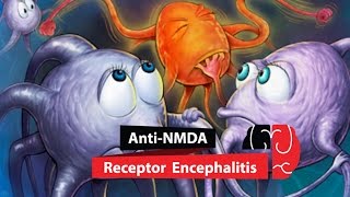 Anti NMDA Receptor Encephalitis [upl. by Ahseym]