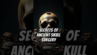 Trepanation Unearthing the Secrets of Ancient Skull Surgery shorts trepanation [upl. by Tiffani]