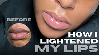 HOW I LIGHTENED MY LIPS IN ONE MONTH USING ONE KEY INGREDIENT [upl. by Asilana]