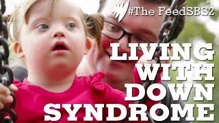 Down Syndrome Life [upl. by Eioj]