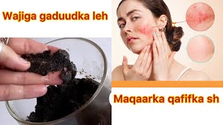 Wajiga gaduudka leh maqaarka qafifka amp qaleelka Alabtan marso diy skincare [upl. by Aiekam713]