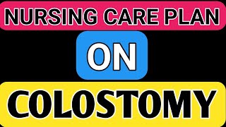 Nursing care plan on ColostomyNCP ON ColostomyCase study on ColostomyAssignment On Colostomy ncp [upl. by Nicks]