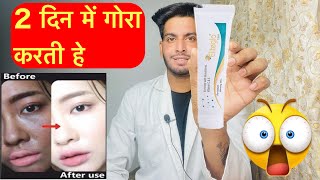 Eliteglo glutathione fairness cream review  Elite glow cream review  Eliteglo cream  eliteglo use [upl. by Anahsohs]