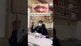 Dry Lips Solution ✅  explore skincaretips shortsviral skindoctor lipgloss [upl. by Lhamaj27]