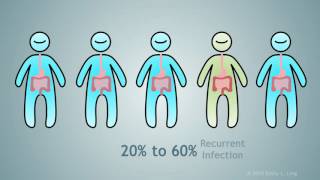 Fecal Microbial Transplantation A Treatment for Clostridium Difficile [upl. by Ettelohcin362]