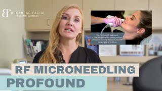 Profound Skin Tightening Treatment Everything you need to know [upl. by Ycniuq775]