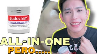 NAGBREAKOUT AKO SUDOCREM FOR ACNE ECZEMA INSECT BITES BABY RASHES  FINAL THOUGHTS [upl. by Nobell548]