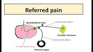 REFERRED PAIN [upl. by Holly]