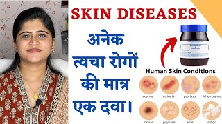 One Medicine for all Skin Diseases ॥अनेक त्वचा रोगों की मात्र एक दवा ॥ [upl. by Barbaraanne778]