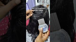 lice amp nits treatment ✅100 result within 2 hrs Chennaiheadlicetreatmentliceremovalnitslicehair [upl. by Targett]