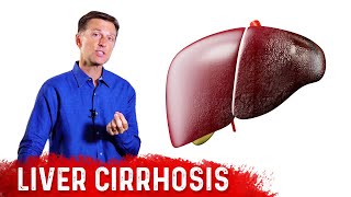 Is Liver Cirrhosis Reversible  Fibrosis vs Cirrhosis – DrBerg [upl. by Mallissa]