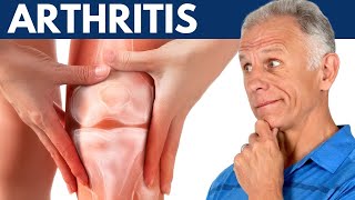 What I Wish Everyone Would Know About Arthritis [upl. by Adnahcir600]