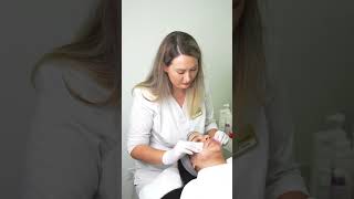 Tratamiento con DERMAPEN [upl. by Avek]