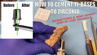 How to Cement TiBases to Zirconia Crowns  Using MicroEtchers and Resin Cement [upl. by Girhiny]