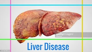 LIVER DISEASE  What Are the Early Signs of Liver Disease You Shouldnt Ignore [upl. by Bill]