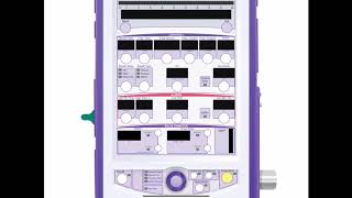 REALITi 360 13 Ventilator [upl. by Ihcego949]