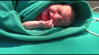 First cry of newborn babyCrying response of newborn [upl. by Stephania]