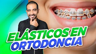 ¿Tus Brackets No Funcionan Los Elásticos Son La Clave [upl. by Aisset966]