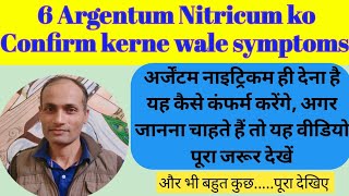 Argentum Nitricum homeopathic medicine Argentum Nitricum ही देना चाहिए 6 Confirmatory symptoms [upl. by Silecara]