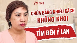 YLanAnswers Trị nám có đau không [upl. by Urbano]