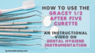 How to use the Gracey 12 After Five Curette [upl. by Altaf]