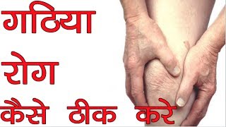 गठिया रोग कैसे ठीक करे  Arthritis Problem  Gathiya ki Bimari [upl. by Krock]