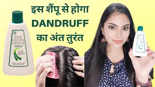 Selsun shampoo for dandruff  Selsun shampoo review  Best antidandruff shampoo review [upl. by Badger]