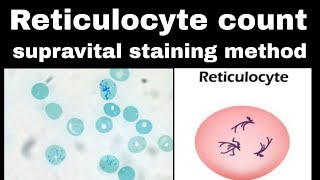 Reticulocyte count  in hindi  ph patho hub  supravital staining method  Dmlt  Bmlt  Hrmatology [upl. by Wera987]