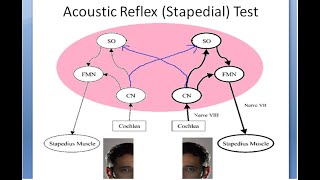 ENT 042 b Acoustic Reflex Stapedial Reflex Muscle Contract Loud Sound Protection Ear Mechanism [upl. by Hiroko594]