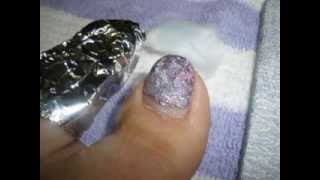 Removing Soakoff Gel Polish on Toes [upl. by Nwahsir]