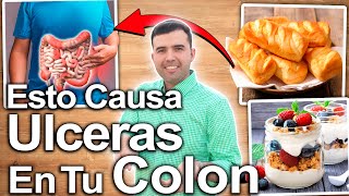 ¿Cómo Curar Las Úlceras En El Colon  Dietas Alimentos y Remedios Naturales Para Reparar Tu Colon [upl. by Horn]