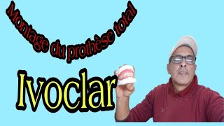 Montage de la prothèse totale avec les dents quotIvoclarquot [upl. by Keenan]