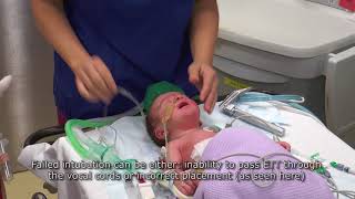 Paediatric Anaesthetics Chapter 3  Failed intubation neonate [upl. by Darrill317]