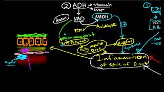 Pathophysiology of Cirrhosis [upl. by Frymire281]