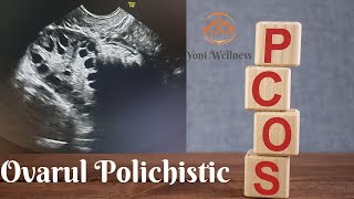 S2 Ep 19  Boala Ovarului Polichistic  PCOS  Simptome  Diagnosic  Tratament  Sarcina [upl. by Mauretta]