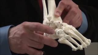 Treatment of Clubfoot Demonstration Large Model [upl. by Nner]