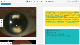 Sympathetic Ophthalmia [upl. by Lehrer]