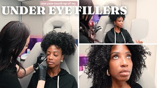 One Year Under Eye Filler Update  Aisha Beau [upl. by Nylirehc]