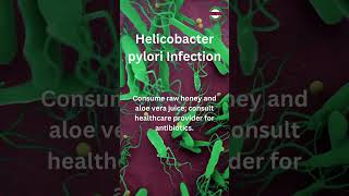 Helicobacter Pylori Infection Of the Stomach [upl. by Nezah779]