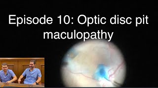 Retina Chats Episode 10 Optic disc pit maculoapthy [upl. by Alyehc]