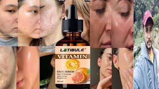 Latibule Vitamin C Face Serum  Honest Review [upl. by Ottavia]