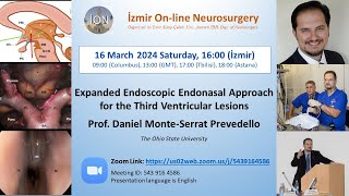 İON 429 Lecture Prevedello Expanded Endoscopic Endonasal Approach for the 3rd Ventricular Lesions [upl. by Ylloh]